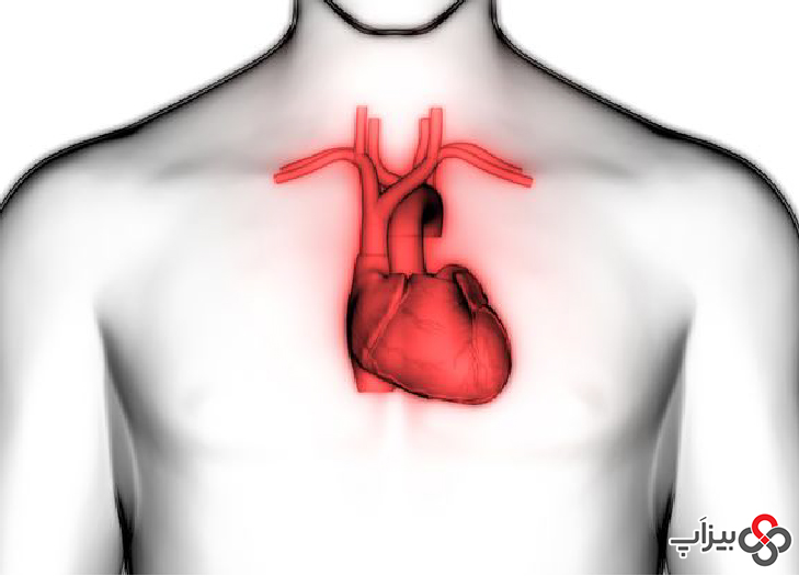4. خطر سکته قلبی