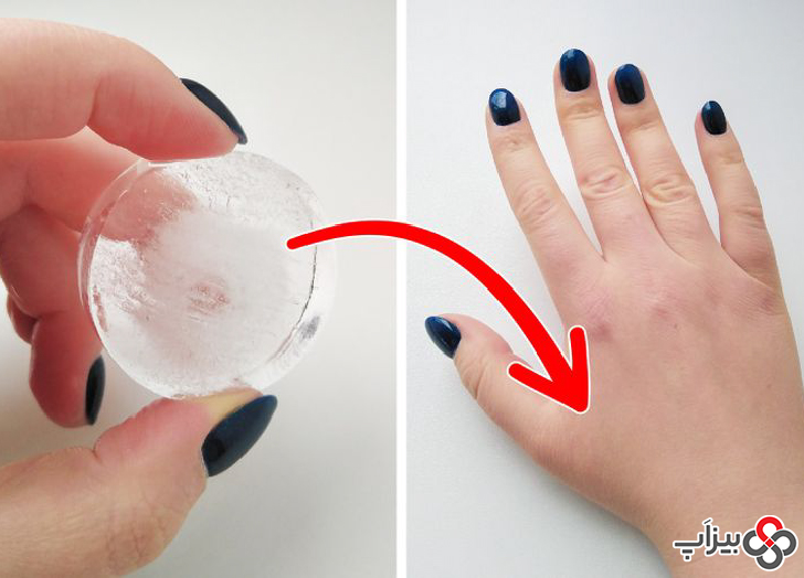 2. با قرار دادن یک قالب یخ روی پشت دست خود بین انگشت اشاره و شست دندان درد را از بین ببرید